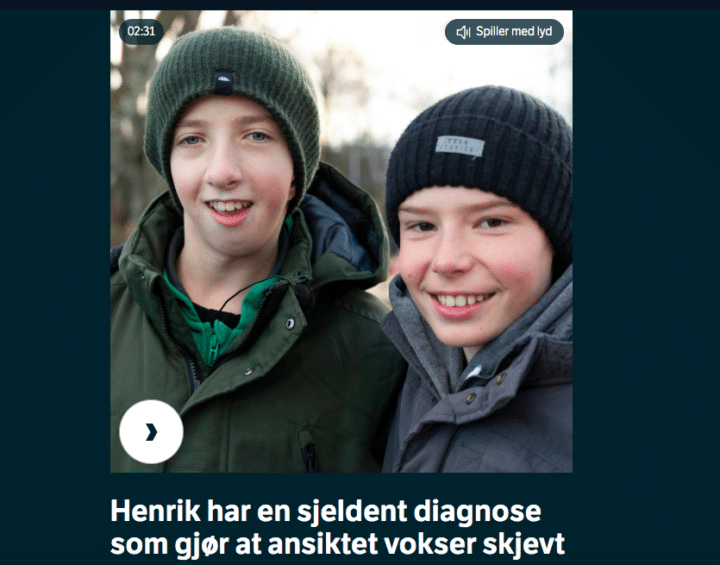 Skjermbilde av videoen med tittel Henrik har en sjelden diagnose som gjør at ansiktet vokser skjevt på NRK